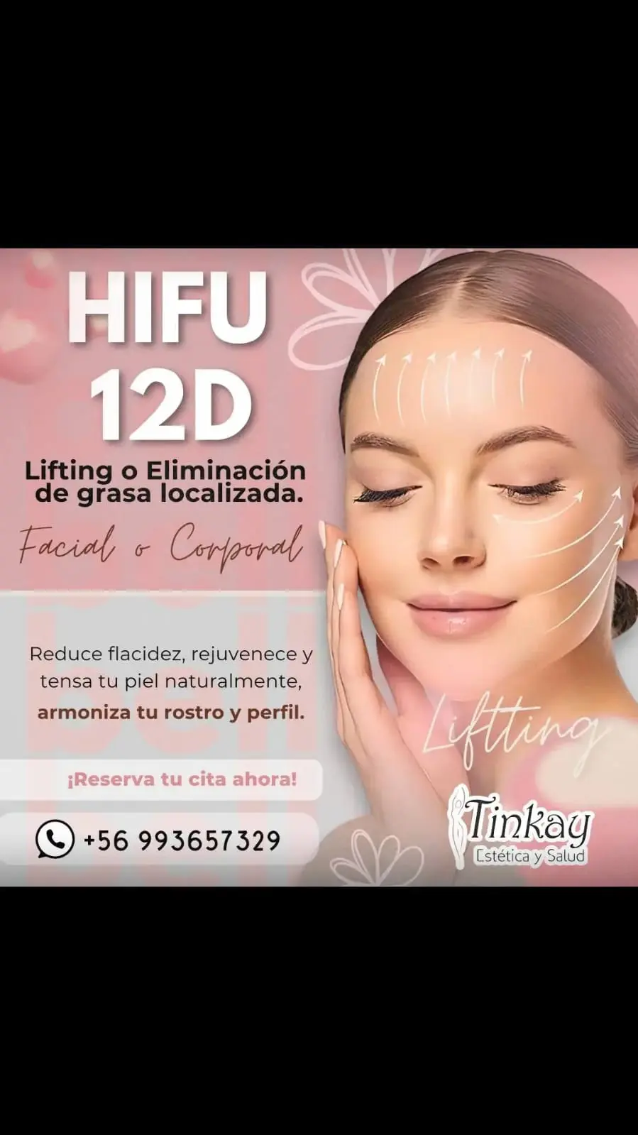 Lifting HIFU 12D (Rostro y Cuerpo)