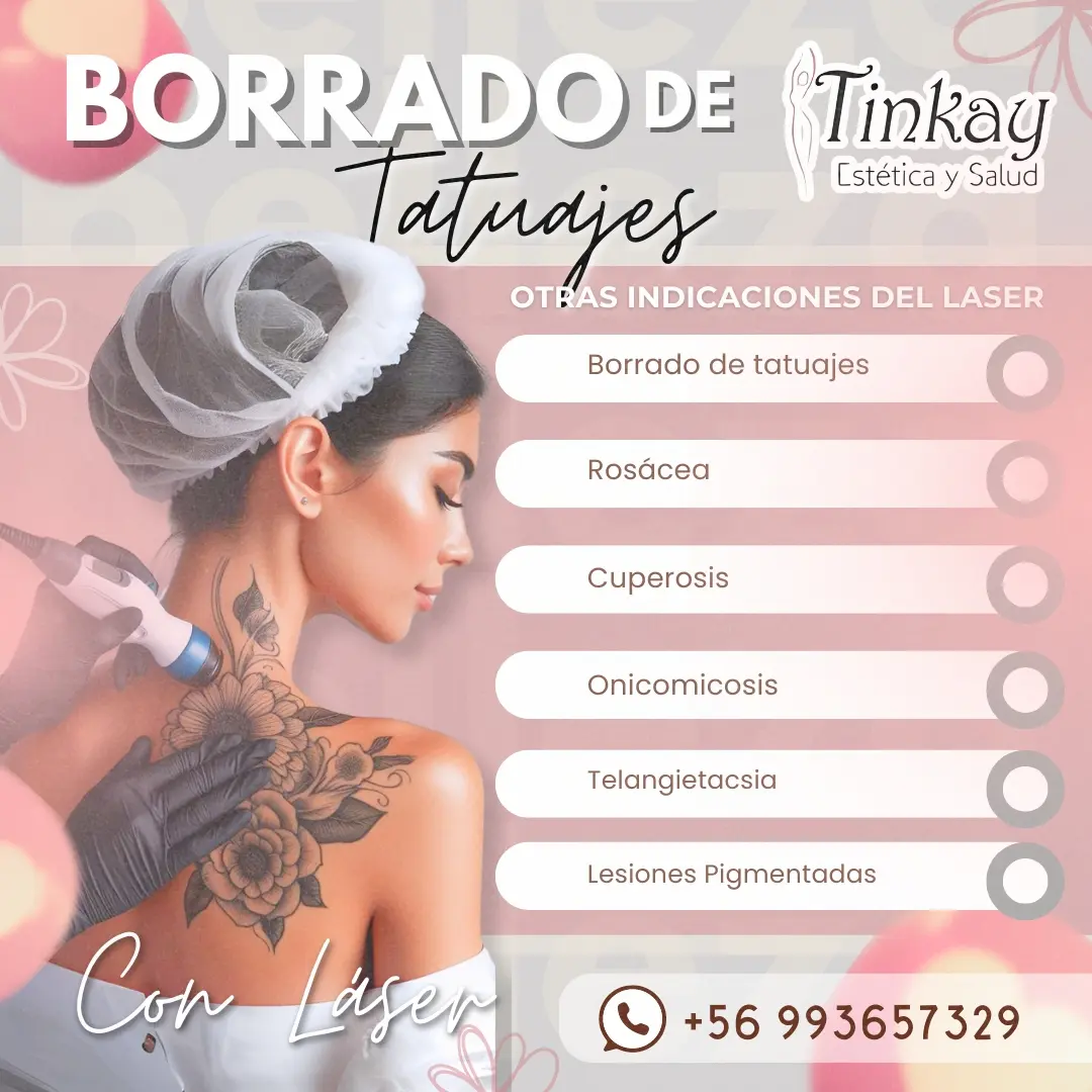 Borrado de Tatuajes y microblading