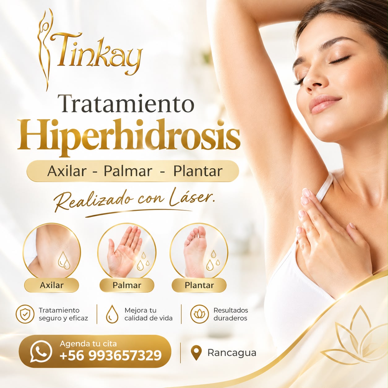 Hiperhidrosis (Láser Yag)