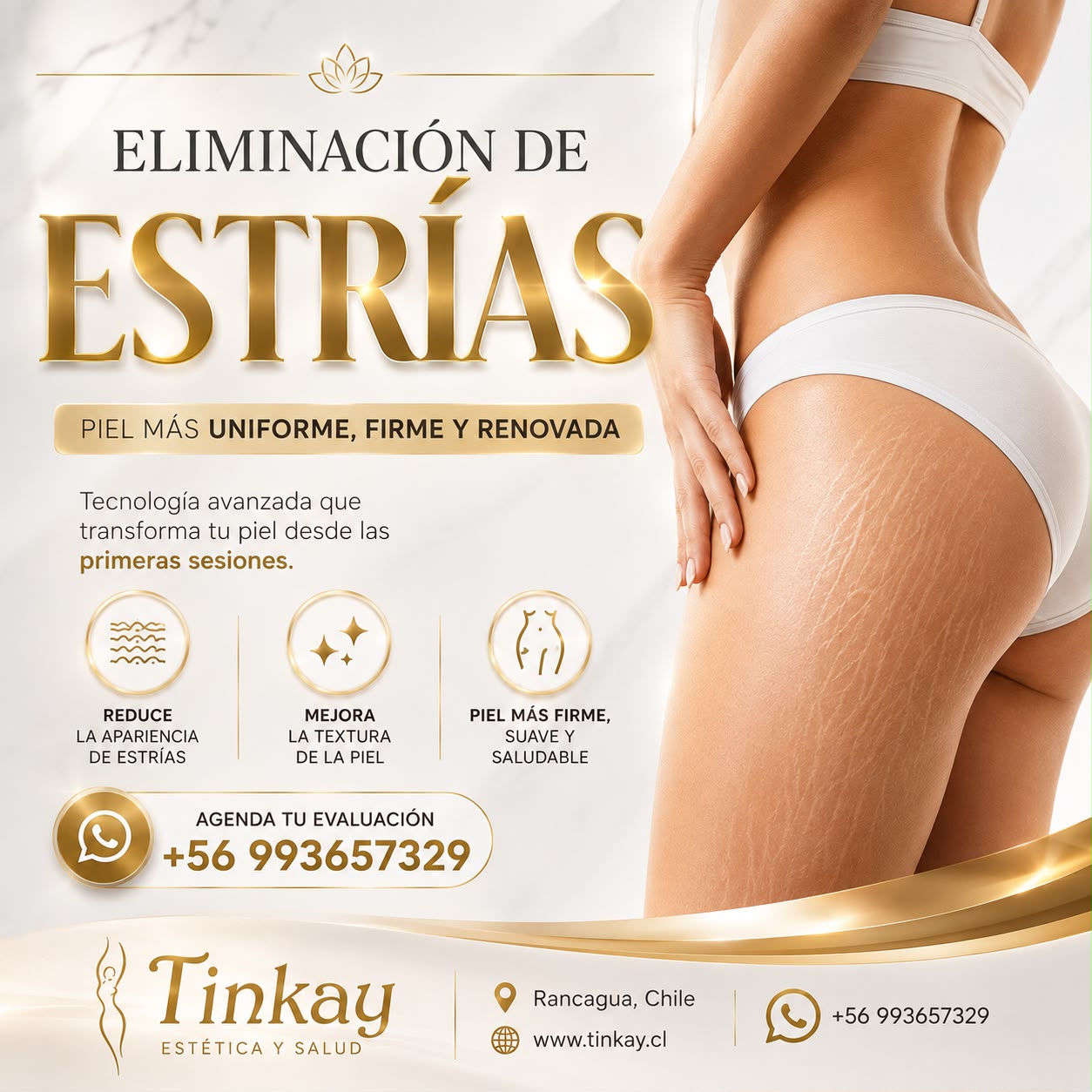 Eliminación de Estrías